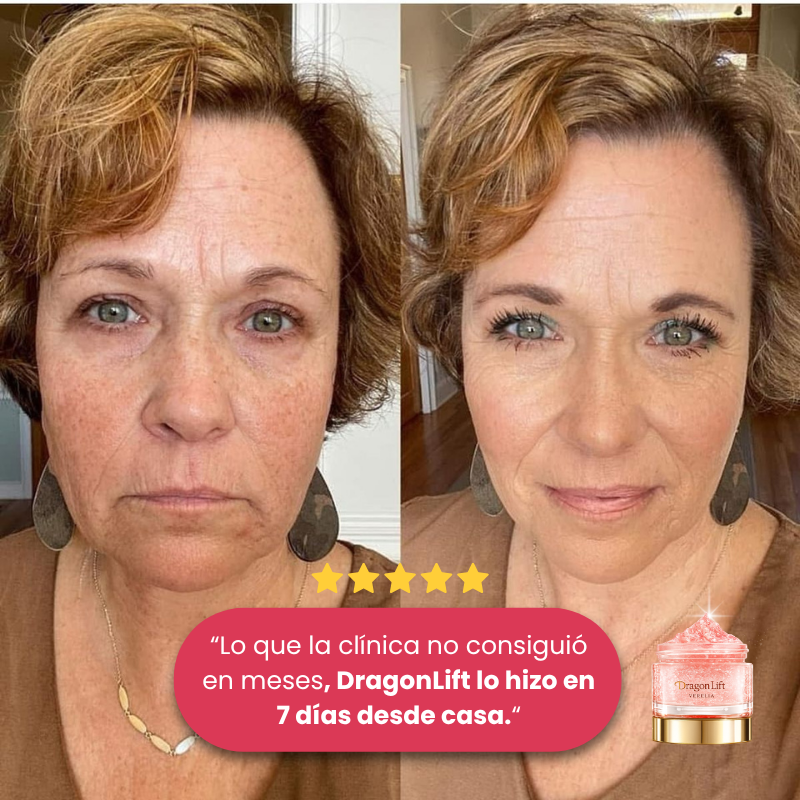 DragonLift™ – Elimina las Arrugas en 7 Días | ¡1 + 1 GRATIS!