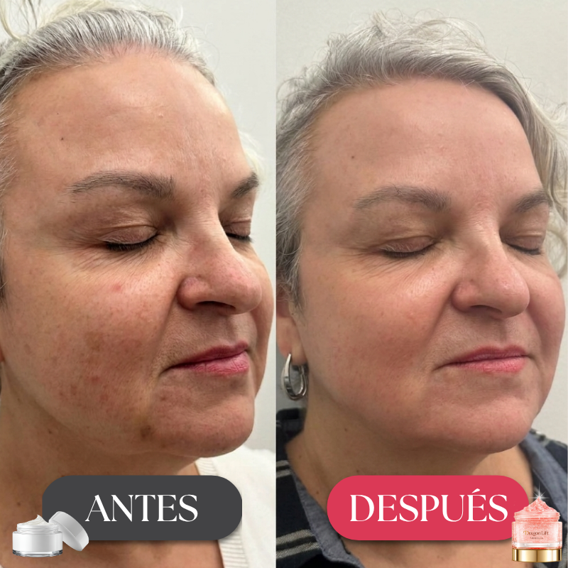 DragonLift™ – Elimina las Arrugas en 7 Días | ¡1 + 1 GRATIS!