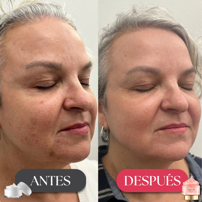 DragonLift™ – Elimina las Arrugas en 7 Días | ¡1 + 1 GRATIS!