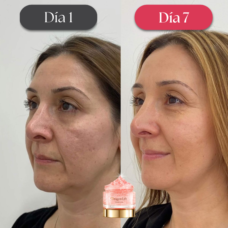 DragonLift™ – Elimina las Arrugas en 7 Días | ¡1 + 1 GRATIS!